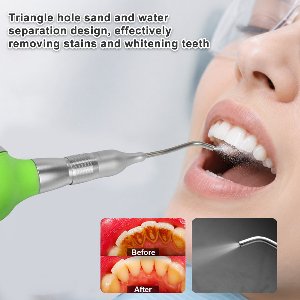 Dental Air Polisher With Anti- - Teeth Whitening Options review and price