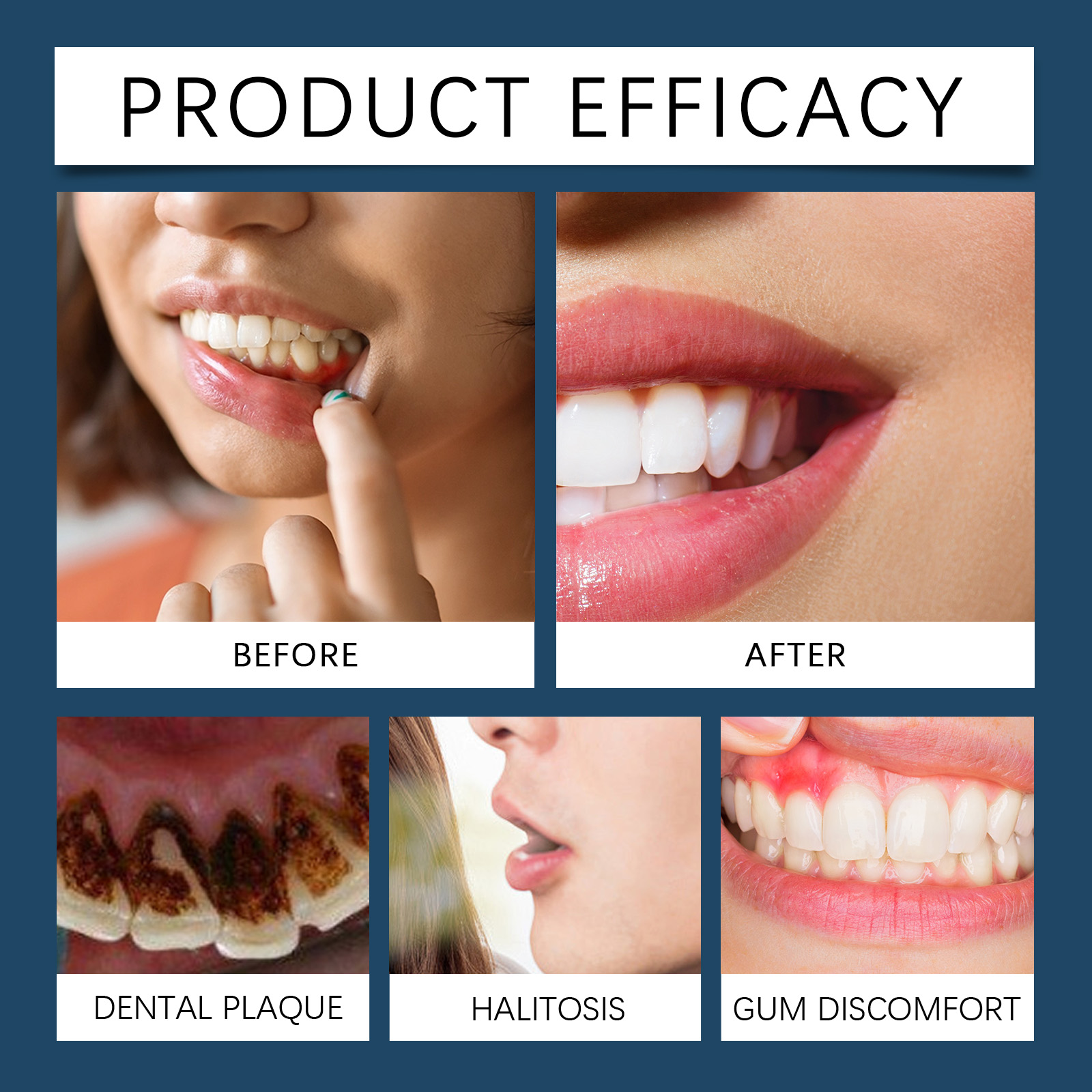 Dental Care Gel Gentle Cleanin - Teeth Whitening Uv review and price