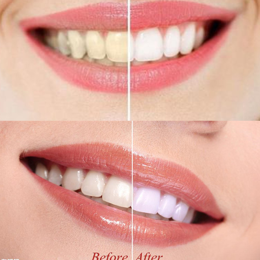 Bamboo Charcoal Teeth Tooth De - Teeth Whitening From Home review and price