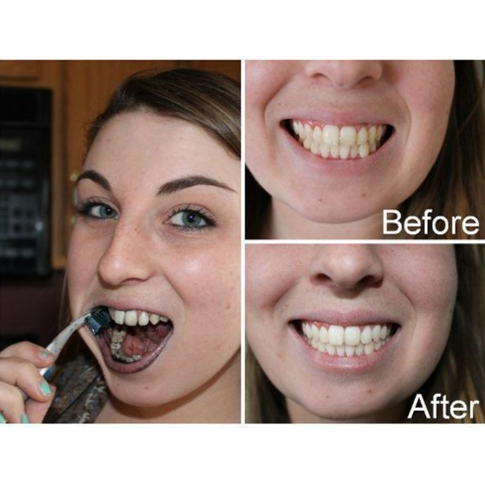 Bamboo Charcoal Teeth Tooth De - Teeth Whitening From Home review and price
