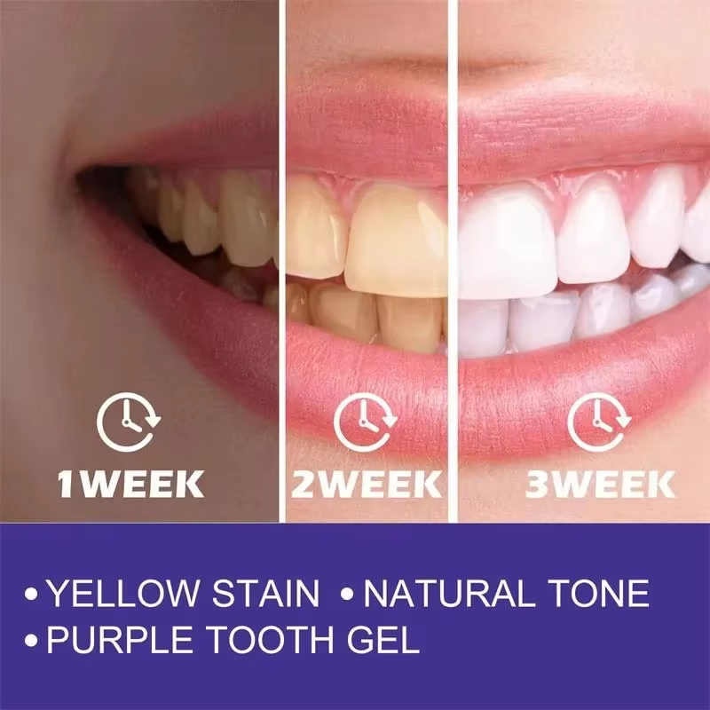 Teeth Cleansing Whitening Toot - Teeth Whitening In Korea review and price