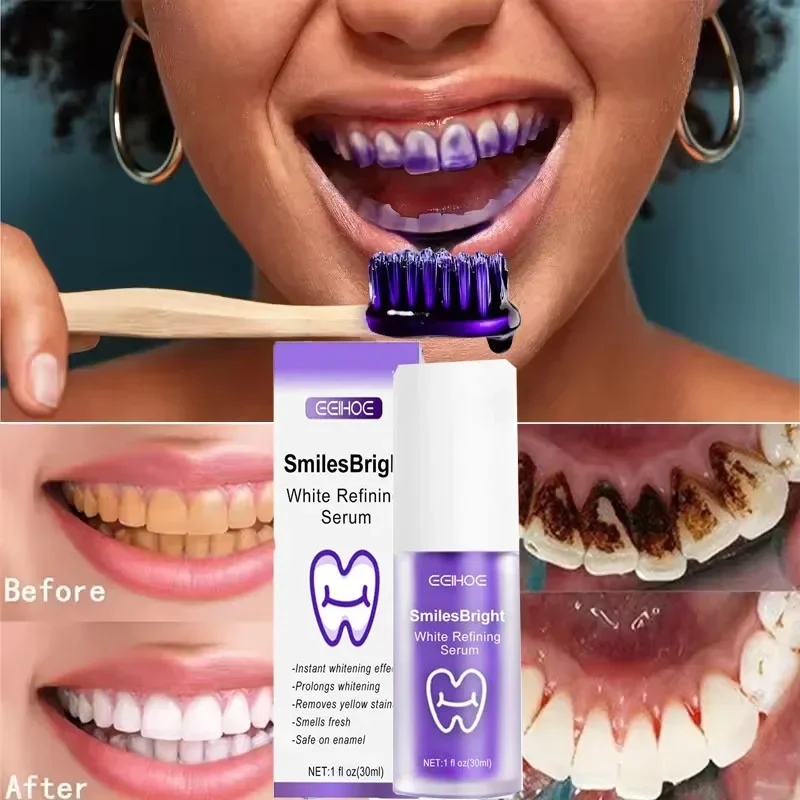 Teeth Cleansing Whitening Toot - Teeth Whitening In Korea review and price