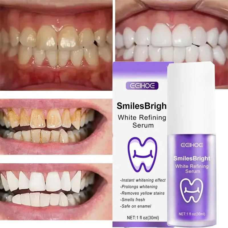 Teeth Cleansing Whitening Toot - Teeth Whitening In Korea review and price
