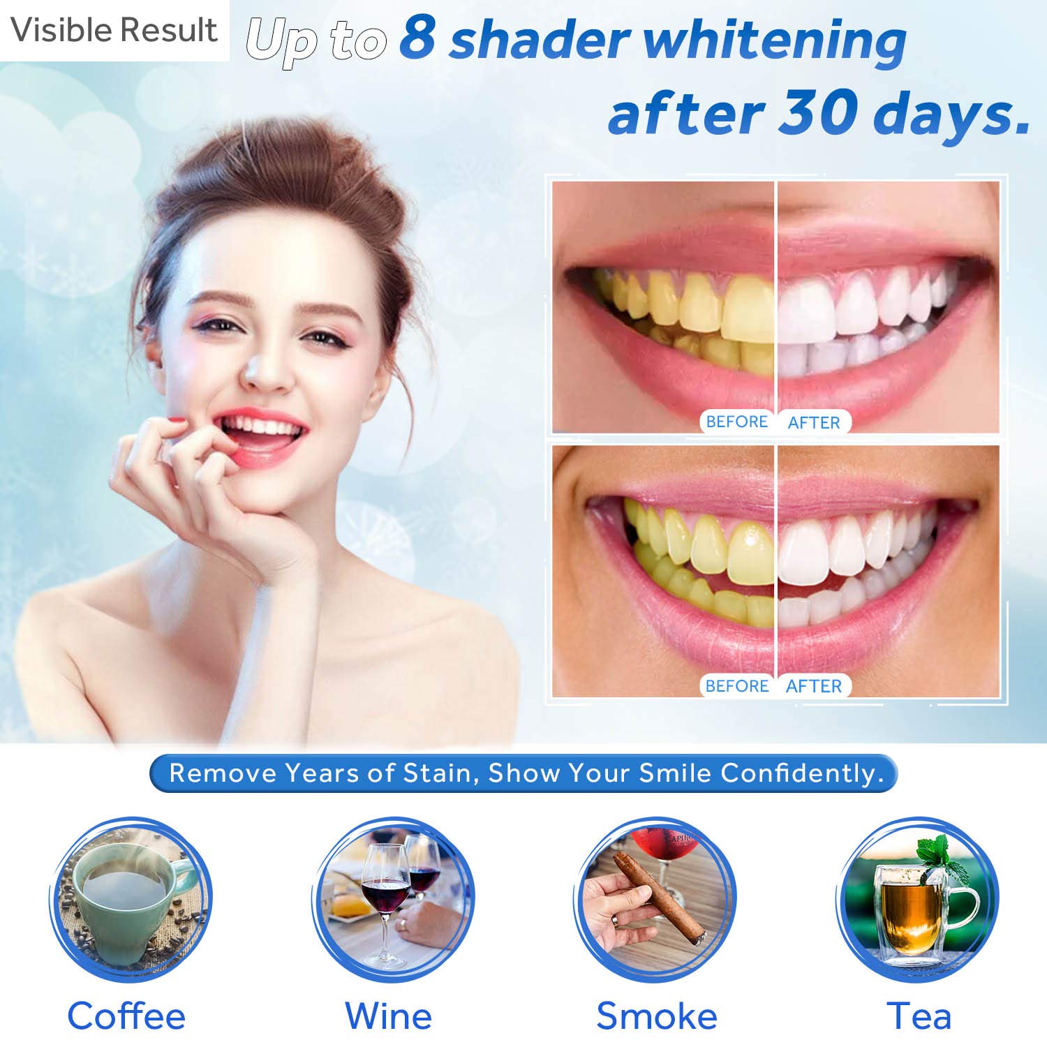 Teeth Whitening Gel Refill Syr - Teeth Whitening Hydrogen Peroxide review and price