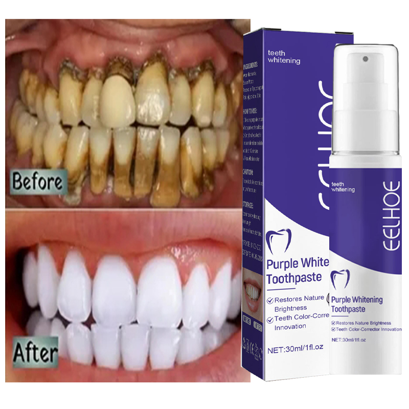 1pcs Teeth Cleansing Whitening - Teeth Whitening In Korea review and price
