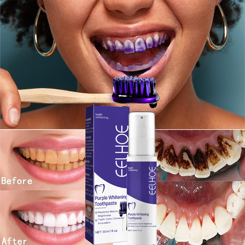 1pcs Teeth Cleansing Whitening - Teeth Whitening In Korea review and price
