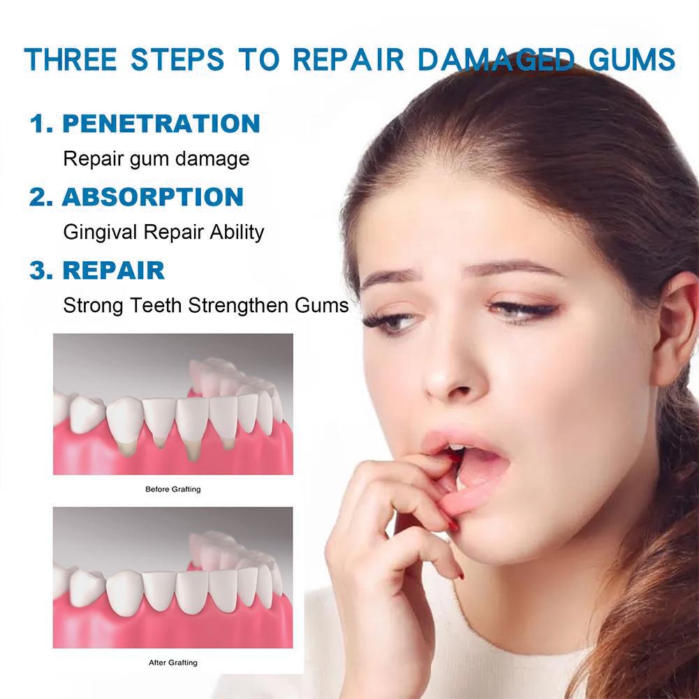 Dental Care Toothpaste Natural - Teeth Whitening Treatment review and price