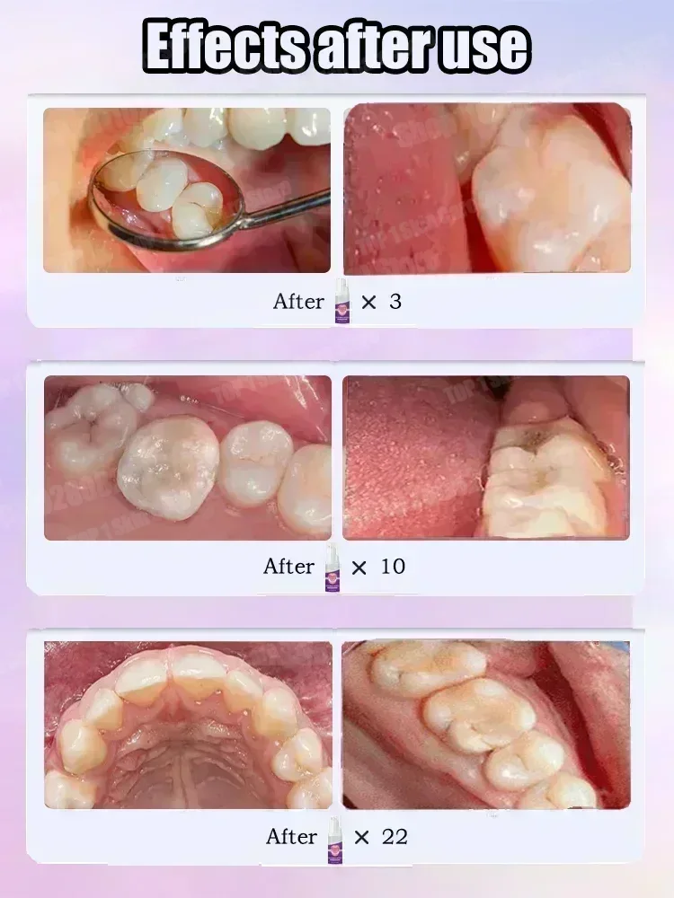 Hot sales Best-selling, Scient - Teeth Whitening Treatment review and price