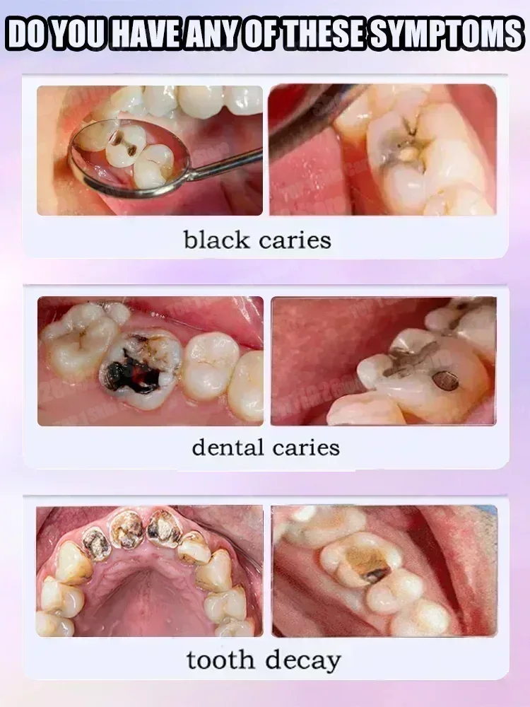 Hot sales Best-selling, Scient - Teeth Whitening Treatment review and price