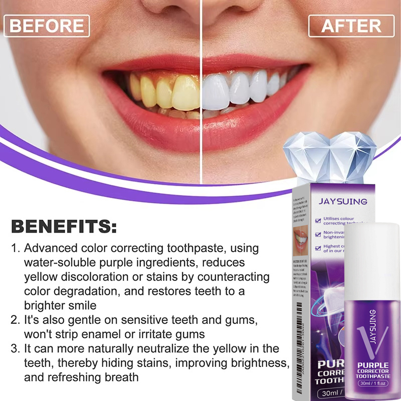 Teeth Cleansing Whitening Toot - Teeth Whitening In Korea review and price