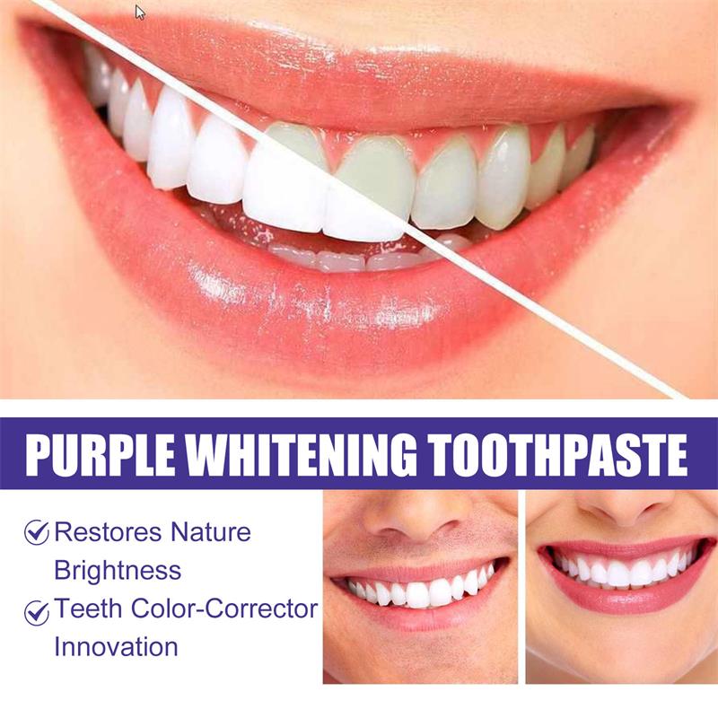 Teeth Cleansing Whitening Toot - Teeth Whitening In Korea review and price