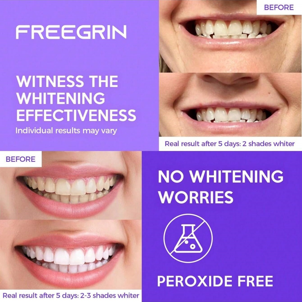 Deluxe Whitening Teeth Sticker - Teeth Whitening Hydrogen Peroxide review and price