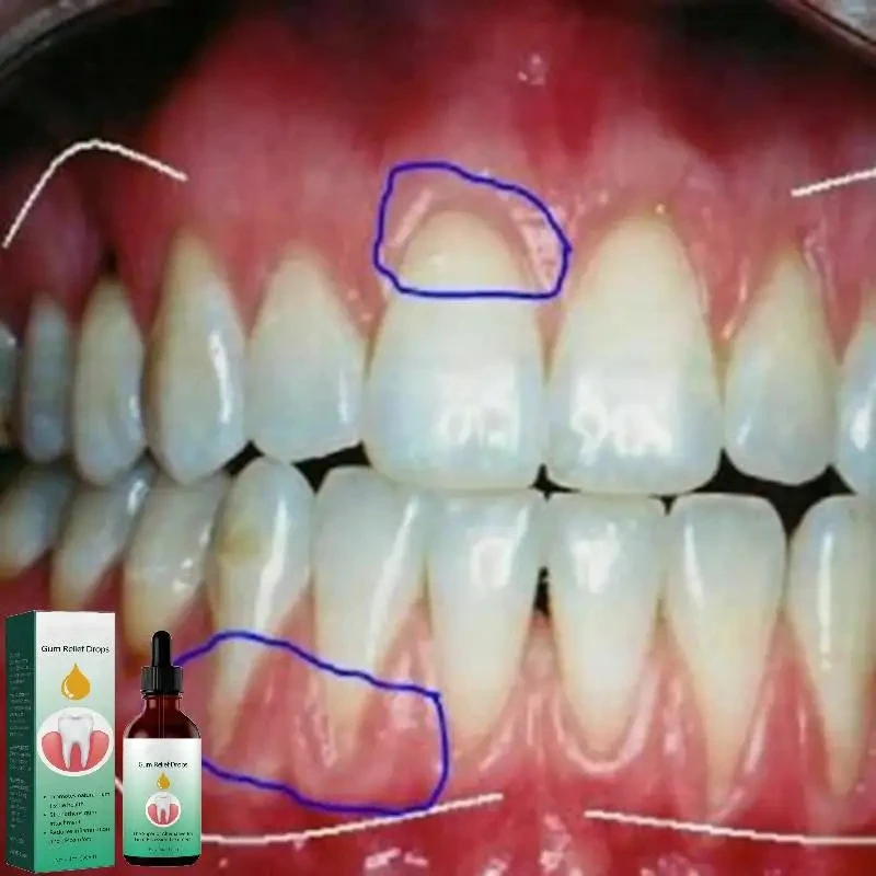 Gum Repair Drops Relieve Reced - Teeth Whitening Paste review and price
