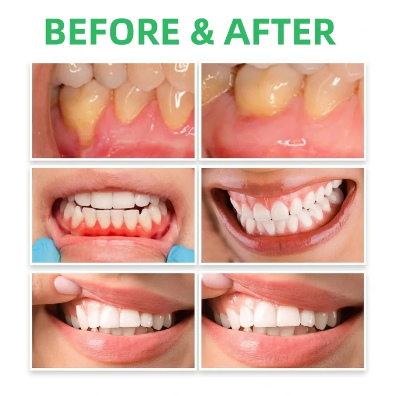 Gum Repair Drops Relieve Reced - Teeth Whitening Paste review and price