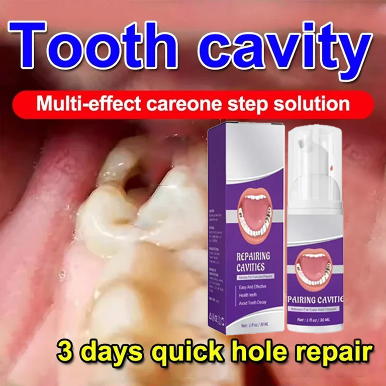 Teeth Cleaning Toothpaste Remo - Teeth Whitening Uv review and price